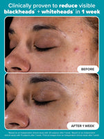 Paula’s Choice Exfoliator 118 ML