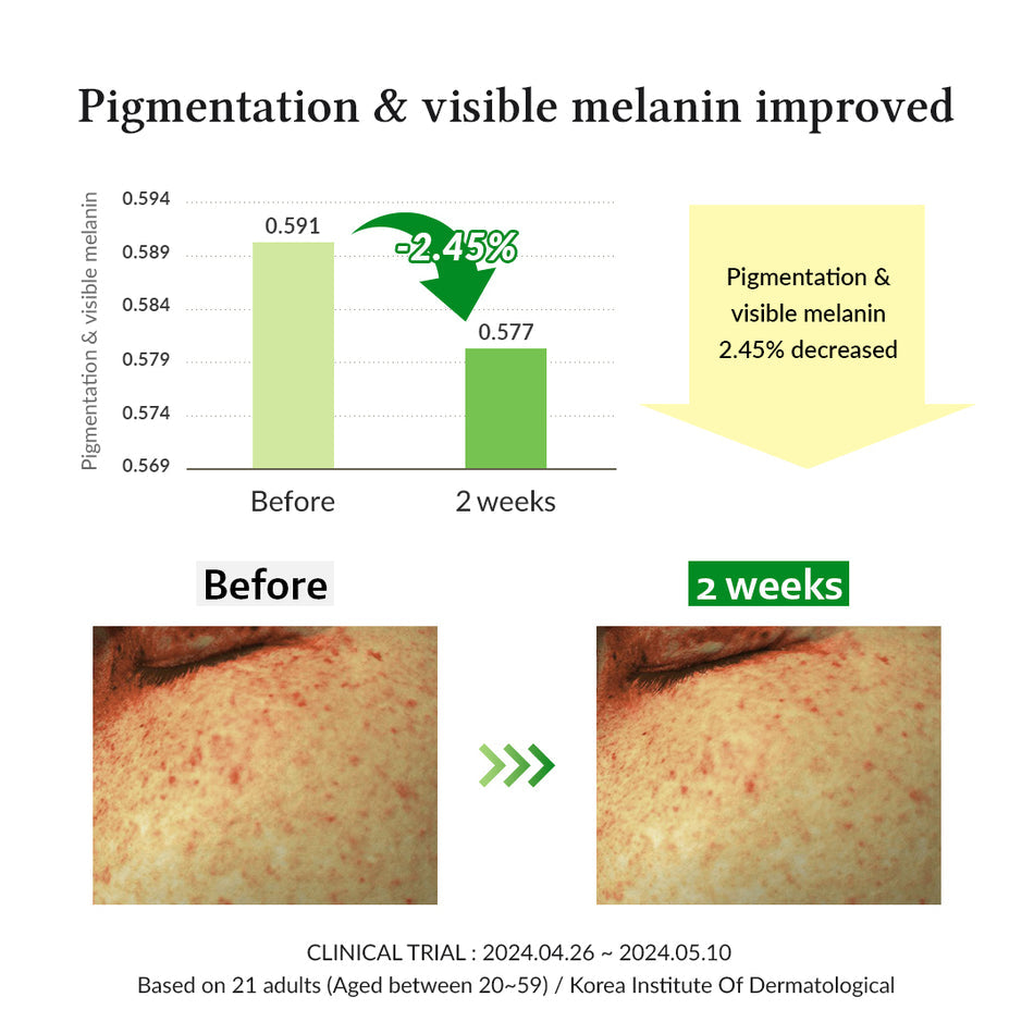 Dr.Althea
Gentle Vitamin C Serum