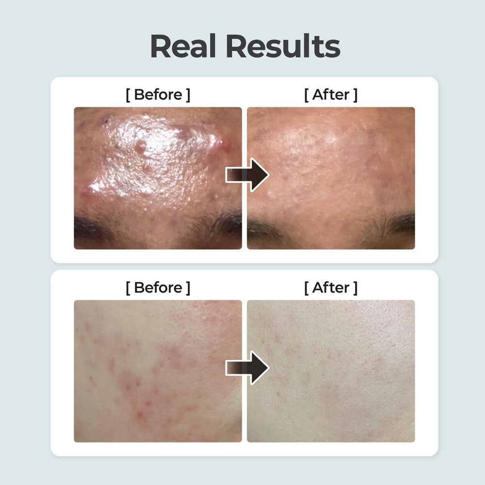 Numbuzin No.1 Pure-Full Calming Herb Toner