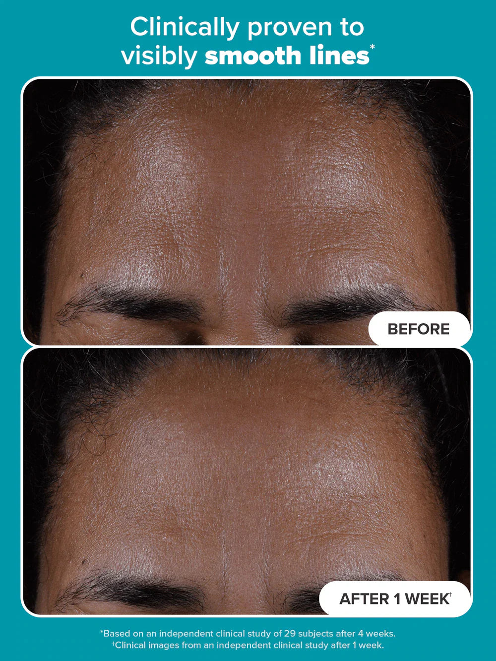 Paula’s Choice Exfoliator 118 ML