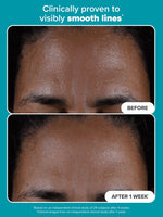 Paula’s Choice Exfoliator 118 ML