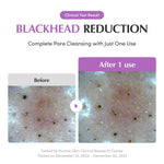 Eqqualberry Purple Rice Pore Purifying Pack Cleanser 130g