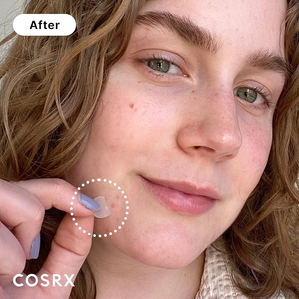 Cosrx Acne + Pimple Master Patches Pack .(24 Patches in one Pack).