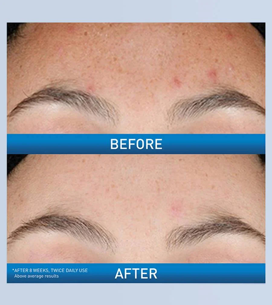 Cerave resurfacing retinol serum