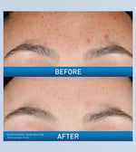 CeraVe Resurfacing Retinol Serum